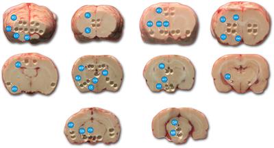 Lorcaserin Alters Serotonin and Noradrenaline Tissue Content and Their Interaction With Dopamine in the Rat Brain